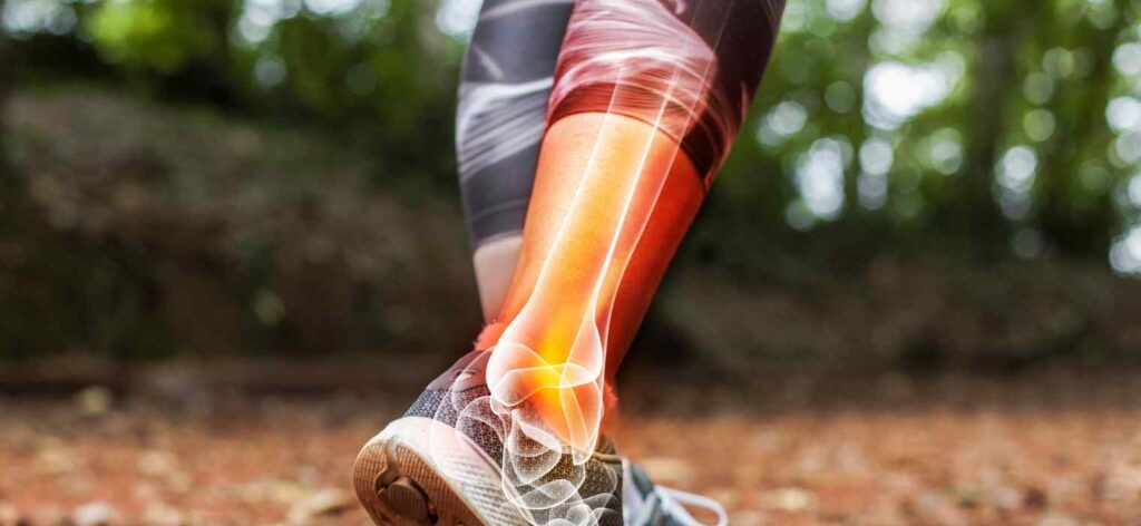 Orthopedic Conditions in Athletes: How to Stay Safe and Recover Right